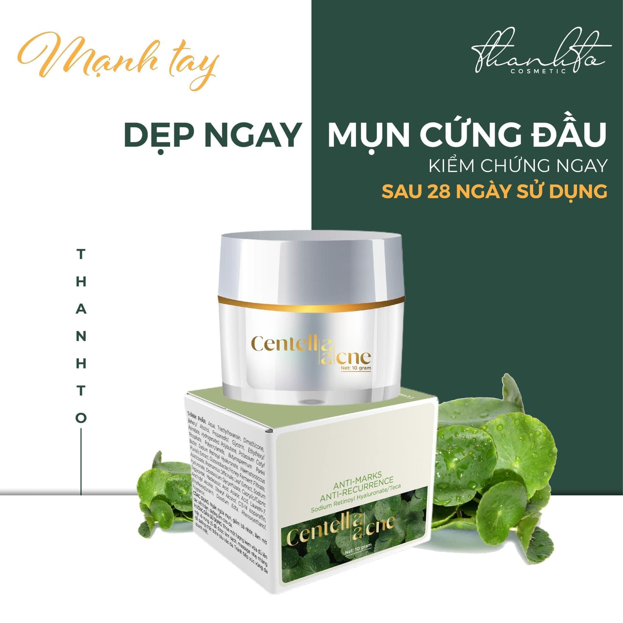 Kem Face Mụn Rau Má Jiuhe Centella Acne Thanh Tô Cosmetics 10g