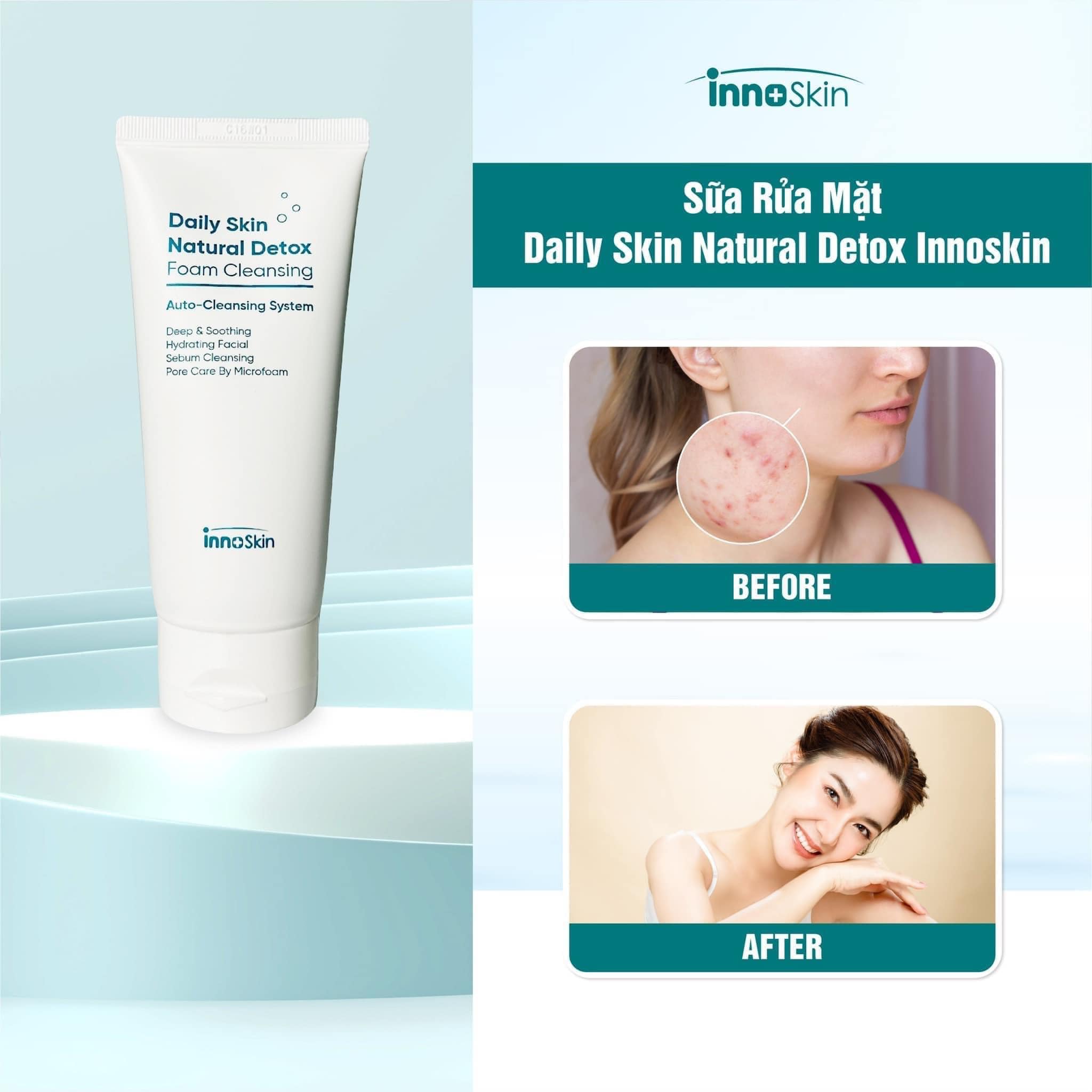 Sữa Rửa Mặt Daily Skin Natural Detox - Foam Cleansing mang lại 6 công dụng ưu việt